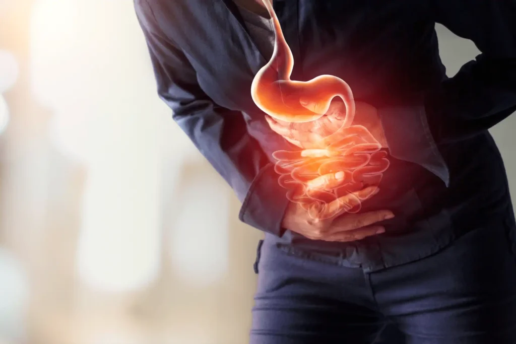 Experts Dispel Myths: Bacteria, Not Spicy Food or Fasting, Cause Stomach Ulcers