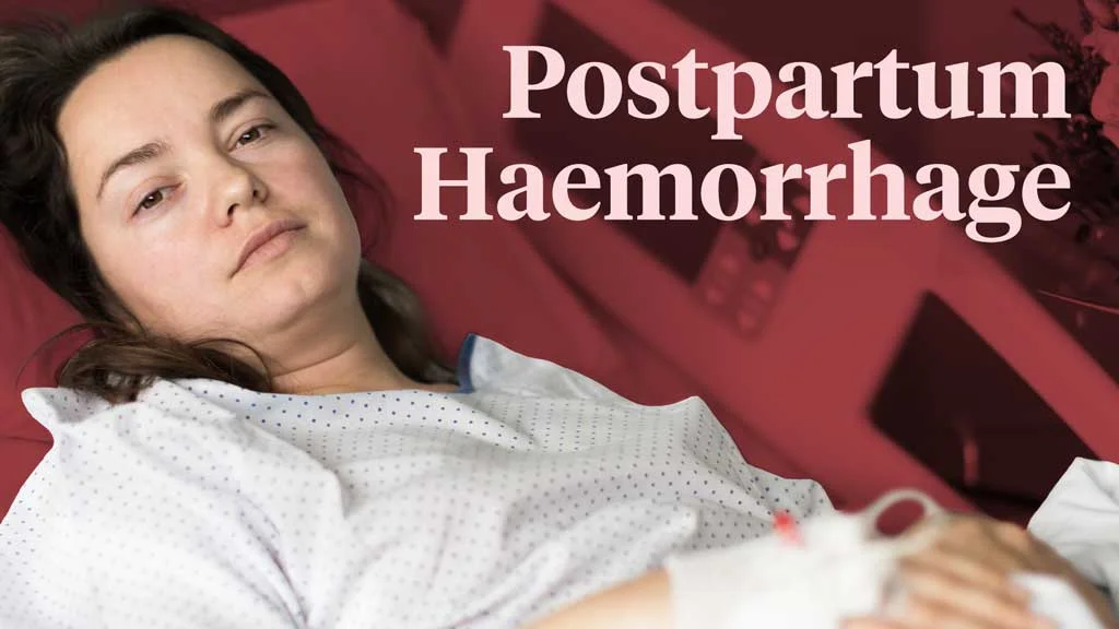 postpartum haemorrhage