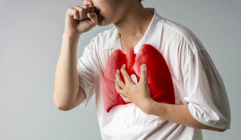 tuberculosis